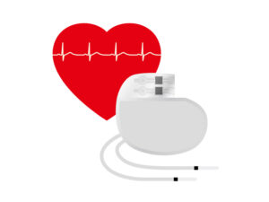 ペースメーカー（ICD/CRT-D）